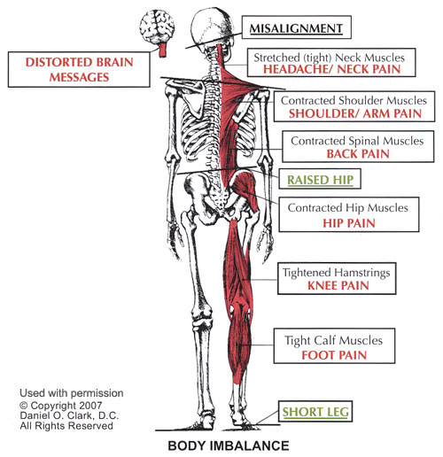 body-imbalance-1